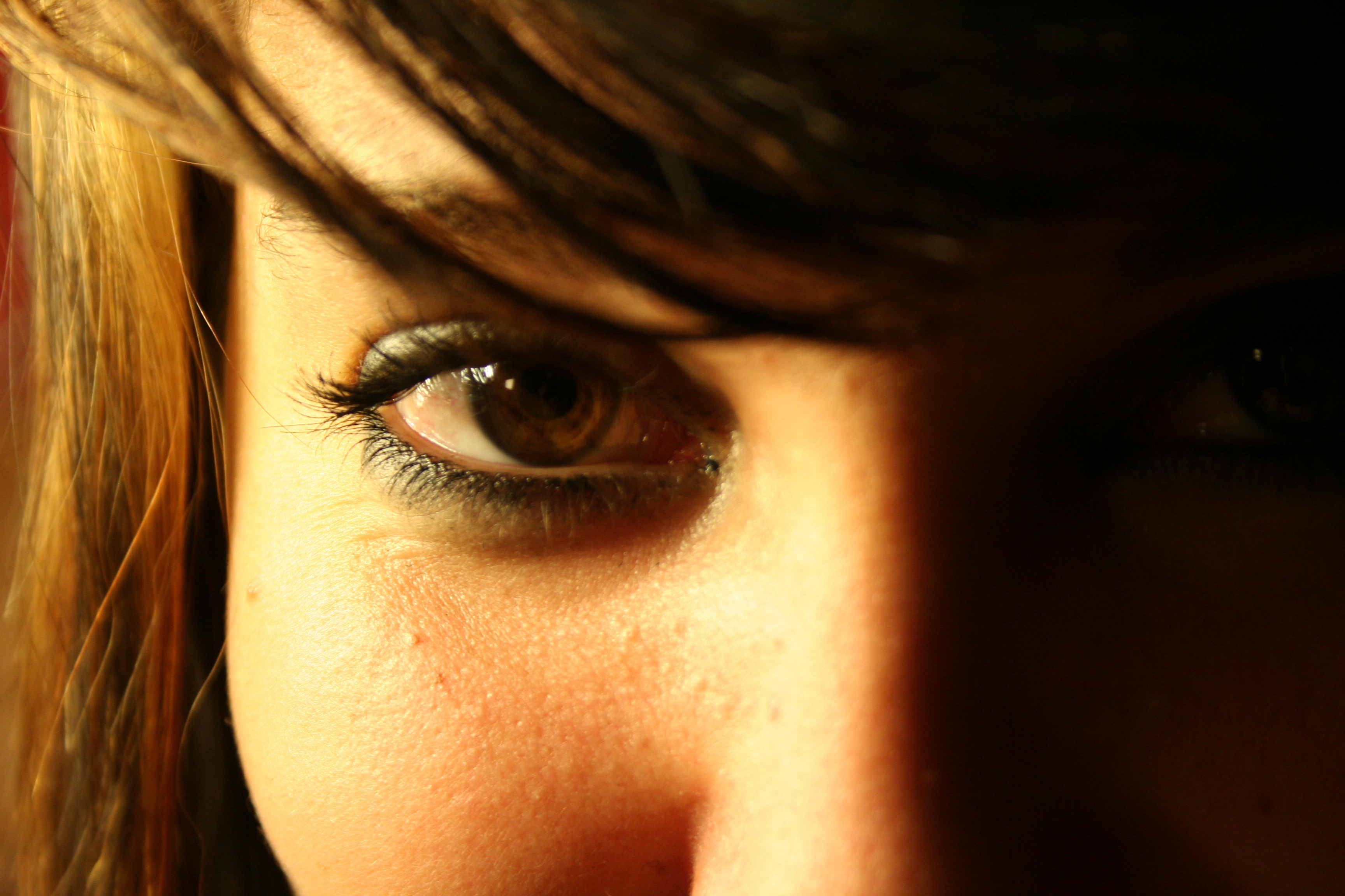 Consultar oftalmologista regularmente pode prevenir câncer nos olhos